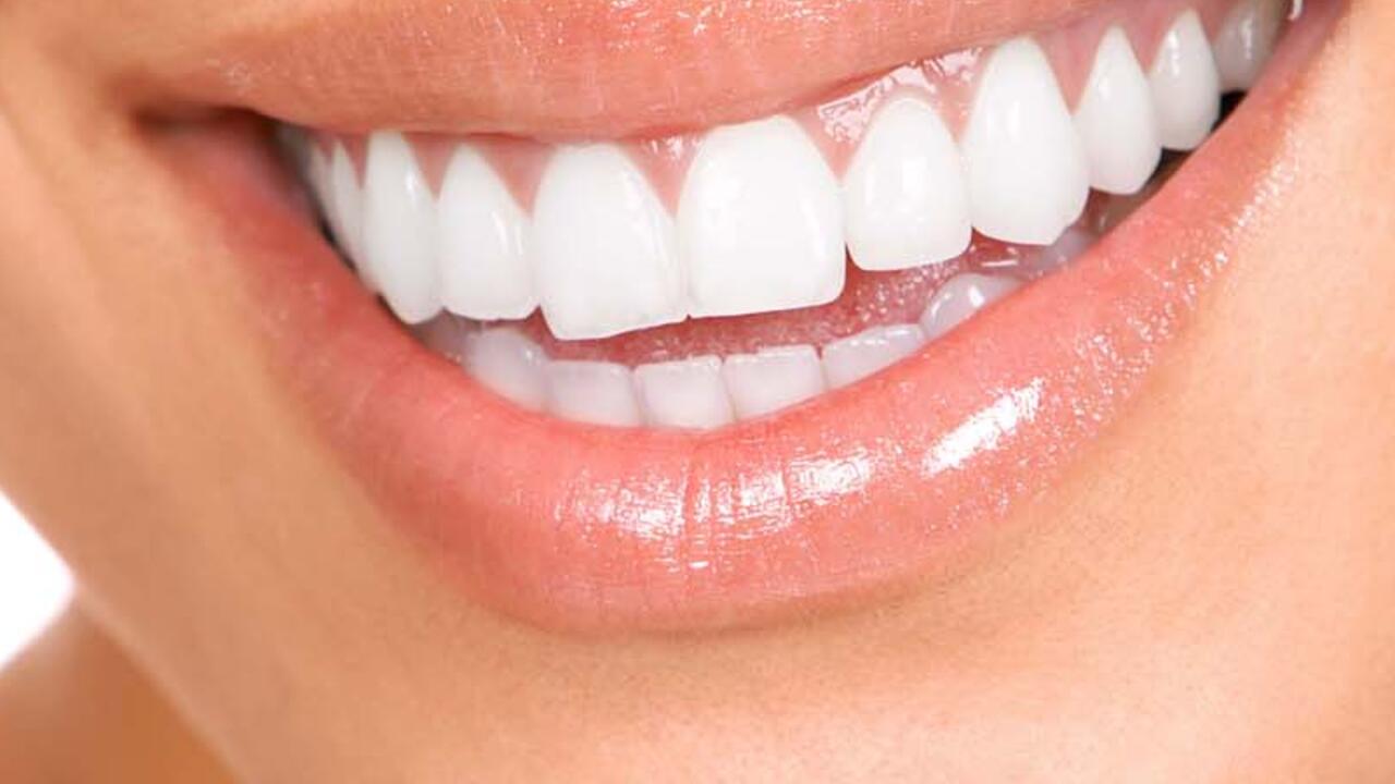 Neden dişlerimin arasında boşluklar var? Diş aralıkları neden oluşur?