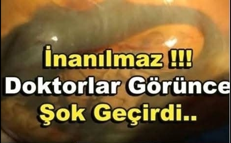 Doktorların Gözünden Kacan