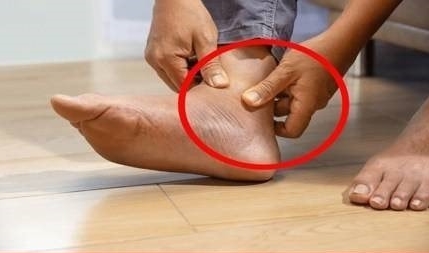 Kalbinizin ve damarlarınızın