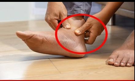 Kalbinizin ve damarlarınızın kötü durumda