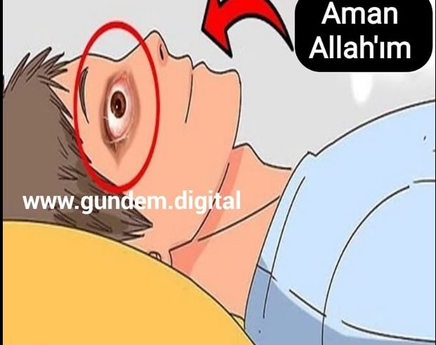 Gözleri Neden Açık Kalır