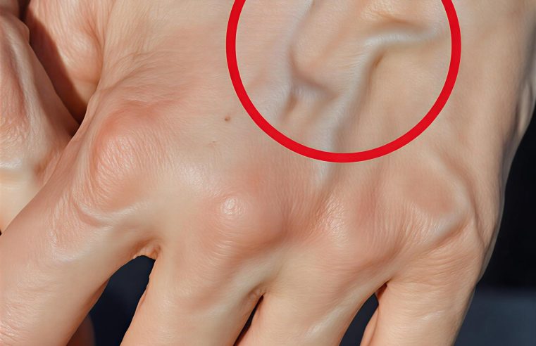 Görünür Damarlar Ne Anlama Gelir