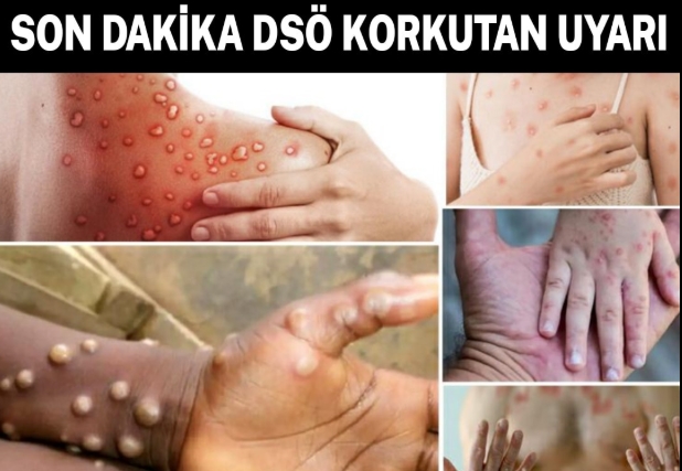 DSÖ virüs hakkında uyardı!