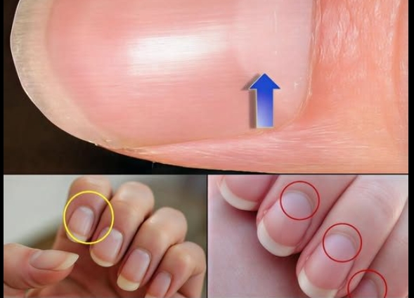 Tırnakların Tabanındaki Yarım Ay Ne Anlama Gelir?