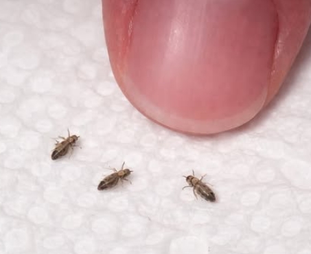 Eşim küçük çocuğumuzun saçını kontrol ederken bunu fark etti