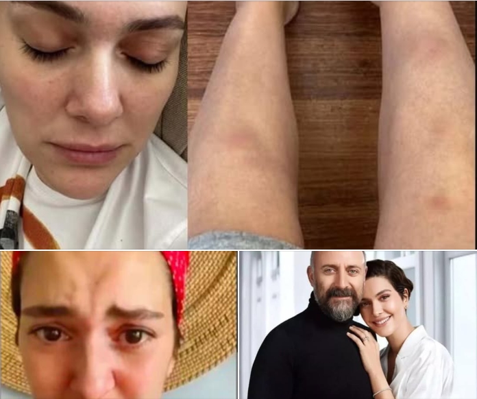 Bir süre önce Türkiye’den ayrılıp başka ülkede yaşamaya başlayan Bergüzar Korel