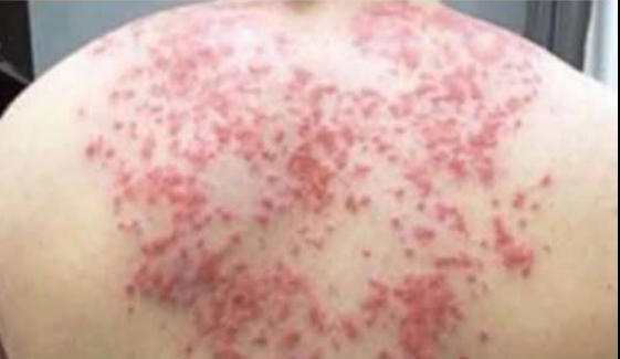 Uzmanlardan Şaşırtan Uyarı