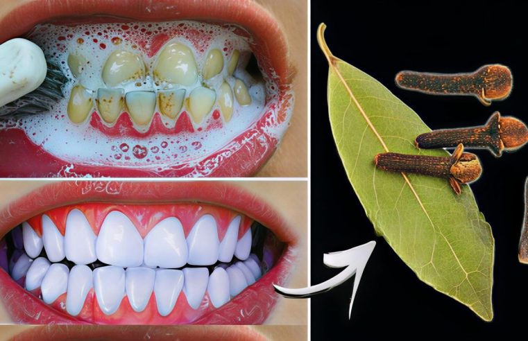 Diş Hekimlerinin bilmenizi istemediği sır: Sadece 2 dakikada Diş Beyazlatma