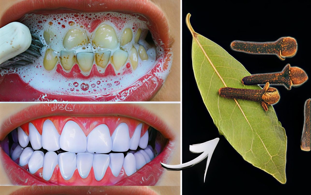 Diş Hekimlerinin bilmenizi istemediği sır: Sadece 2 dakikada Diş Beyazlatma