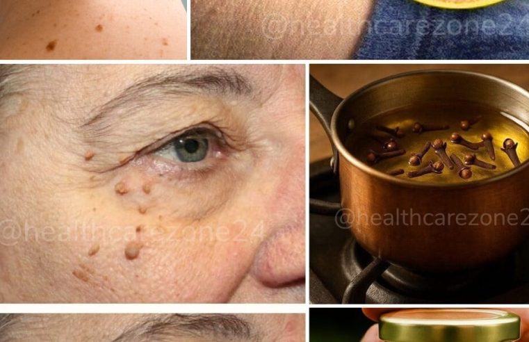 Cildinizdeki et benlerinden kurtulmak bundan sonra hayal değil