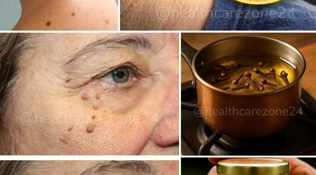 Cildinizdeki et benlerinden kurtulmak bundan sonra hayal değil