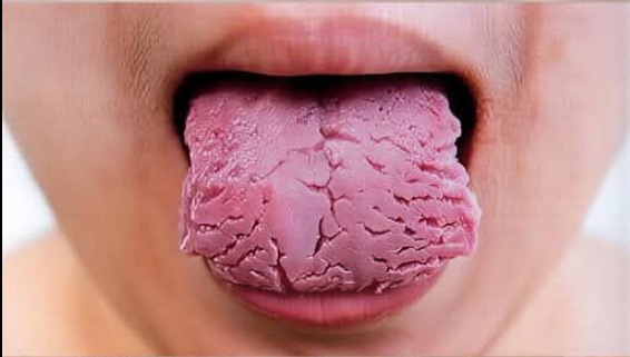 Dilinizin Sizi Uyarmaya Çalıştığı İşaret