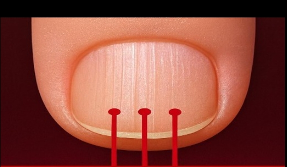 Akciğer Kanserinin En Sinsi 9 Belirtisi