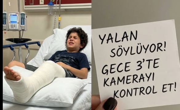 Oğlumun bacağı kırıldıktan sonra ona bakmak için hastaneye gittim