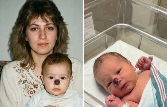 Torunumun Burnundaki doğum lekesini görünce kalbim duracak gibi oldu