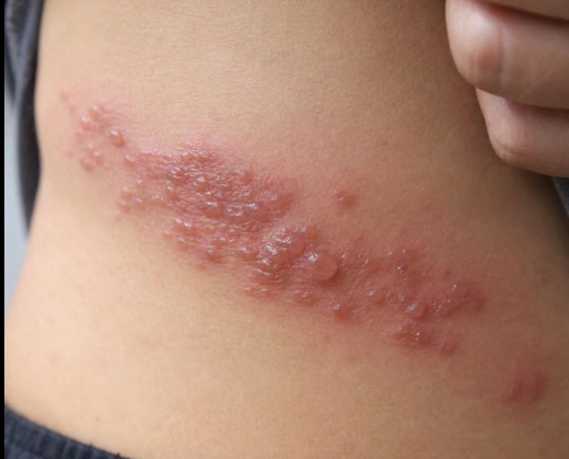 Bu sessiz hastalığın gizli gerçeği