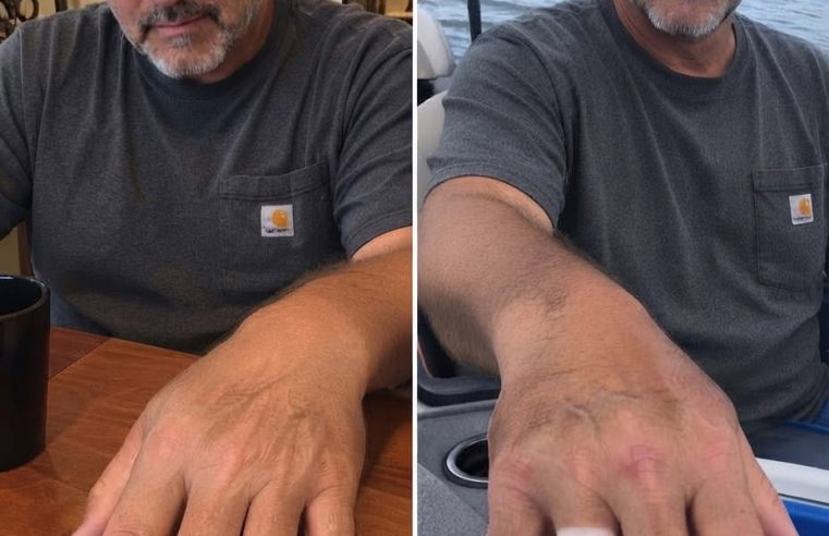 I Noticed a Fresh Ring Mark on My Husband’s Finger After His Fishing Trip, Then His Explanation Made Everything Worse